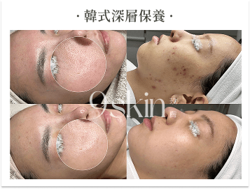 韓式深層保養