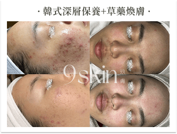 韓式深層保養+草藥煥膚