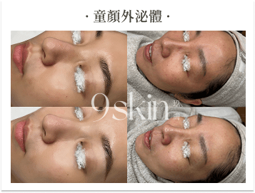童顏外泌體